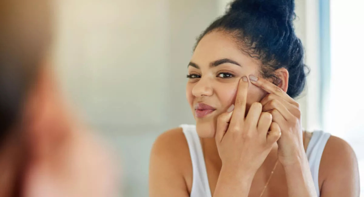 Sivilceyi ne kurutur? Sivilceleri Kurutmak İçin Hızlı Etkili Sivilce Kurutucu 12 Yöntem