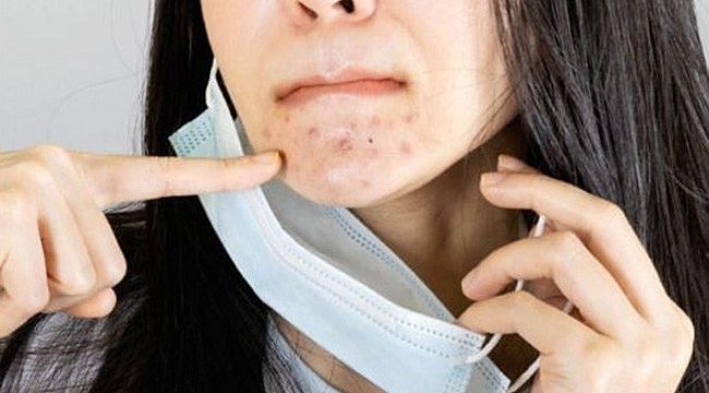 Maske kullanırken cilt sorunları nasıl önlenir?