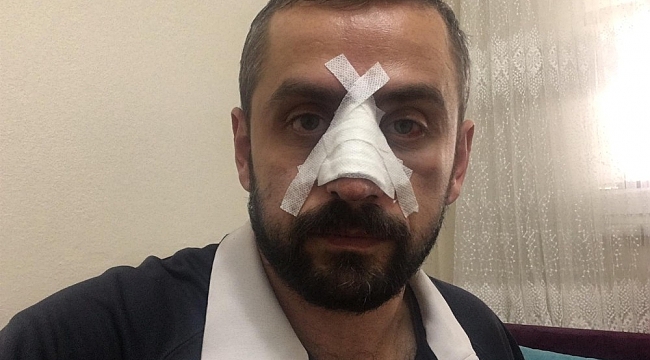 Gazetecilerin can güvenliği tehlikede