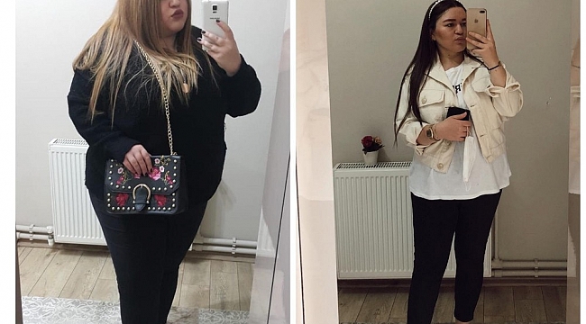 Mide küçültme ameliyatı ile 9 ayda 58 kilo verdi