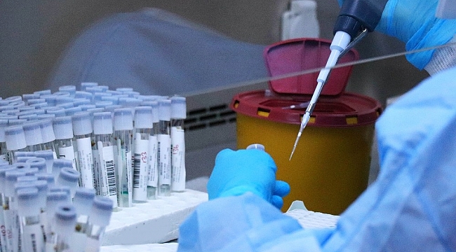 Samsun'da günlük test kapasitesi ise 5 binden 7 bine yükseltildi