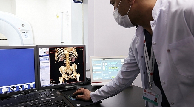 Kilolu hastalarda artık tomografi çektirebilecek