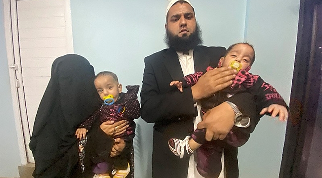 Pakistan'da 9 aylık yapışık ikizler ameliyatla ayrıldı