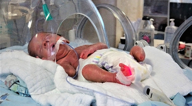 Parmak bebek ayaksız olarak dünyaya geldi