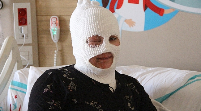 Başından aşağıya çaydanlık dökülen kadın feci şekilde yandı