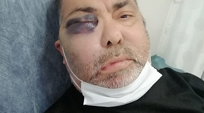 Darp edilen yüzde 90 engelli vatandaş olayında tutuklama kararı