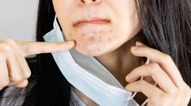 Maske sonrası artan cilt problemlerine önlem de çözüm de su