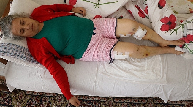 Sokak köpeklerinin saldırısına uğrayan yaşlı kadın ölümden döndü