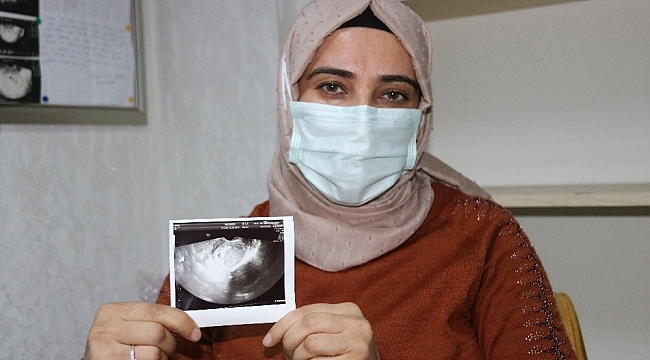 'Çocuğunuz olmaz' denilen çift, Rosi yöntemiyle gebelik haberini aldı