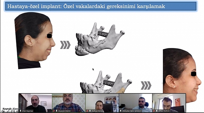 Prof. Dr. Kaymaz: "Hastanelerde 'hastaya özel' implant tasarımı ve imalat birimleri kurulmalı"