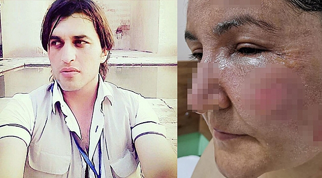 Çocuklarının yanında üzerine kızgın yağ ve kaynar su döktü