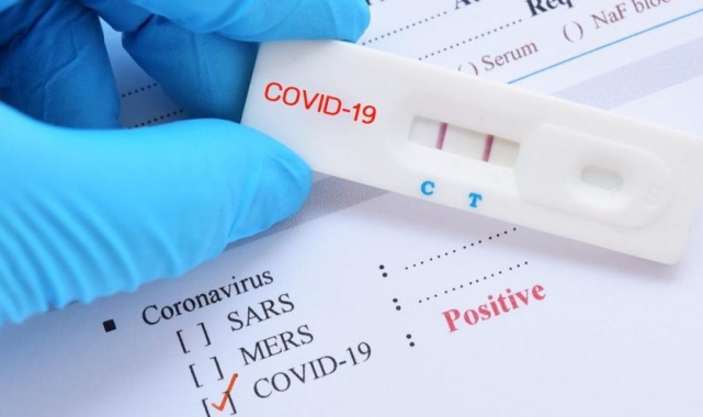 Kovid-19 test sonucunu aynı gün öğrenmek mümkün