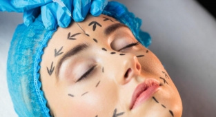 Yüz gerdirme ameliyatı nasıl yapılır?