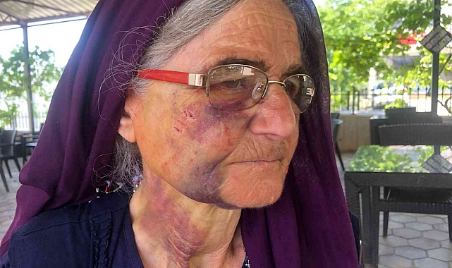 Kuzusunu sürüden almak isterken dayak yedi, yüzü tanınmaz hale geldi