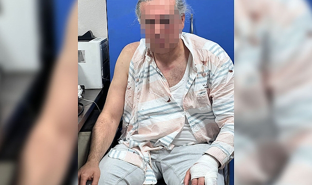 Doktor cinnet geçirdi; Amca oğlunu öldürüp iki kuzenini yaraladı