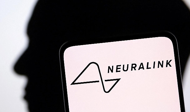 Elon Musk'un Neuralink'i beyin implantı için insan denemesine başlıyor