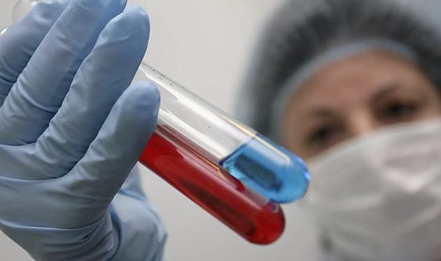 Karabük'te HIV ve HPV pozitif vakalarında artış iddiasına ilişkin açıklama