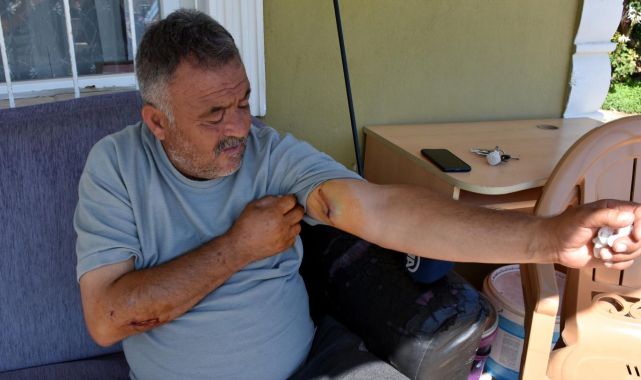 Güvercinlerini beslemek isteyen adama başıboş köpekler saldırdı