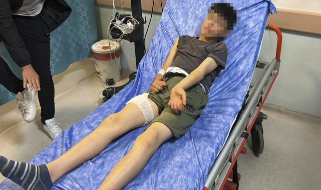 Sivas'ta başıboş köpeğin saldırdığı çocuk yaralandı
