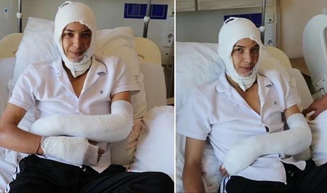 Ağzına götürdüğü elektronik sigara bomba gibi suratına patladı! 17 yaşındaki genç ölümden döndü