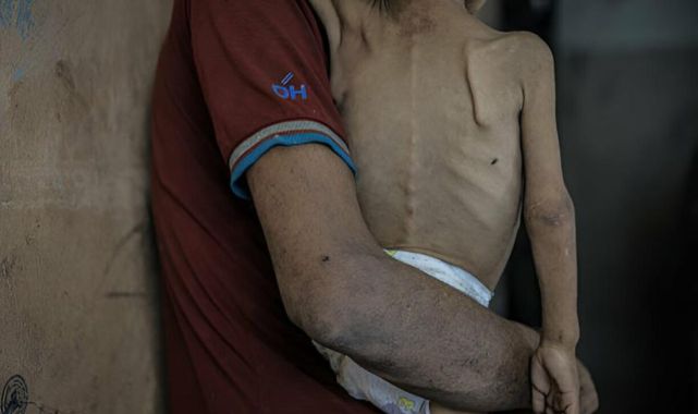 Gazze Şeridi'nde son 24 saatte ikisi çocuk, 5 kişi daha açlıktan hayatını kaybetti