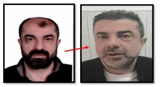 Estetikle yüzünü değiştiren katil zanlısı yakalandı